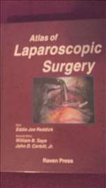 Atlas Laparoscopic surgery