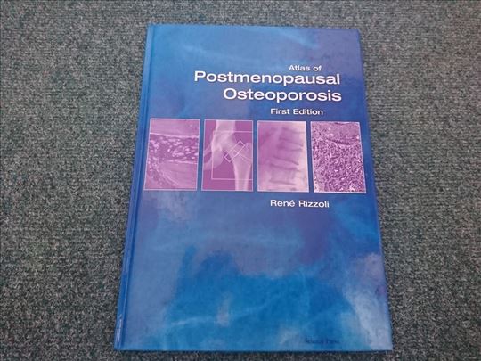 Atlas of Postmenopausal Osteoporosis - Rene Rizzol