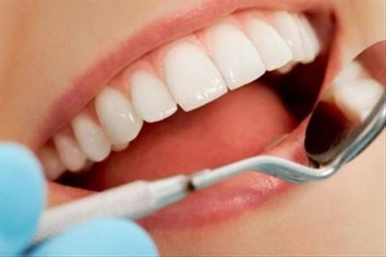 ultrazvučno uklanjanje kamenca, poliranje zuba 