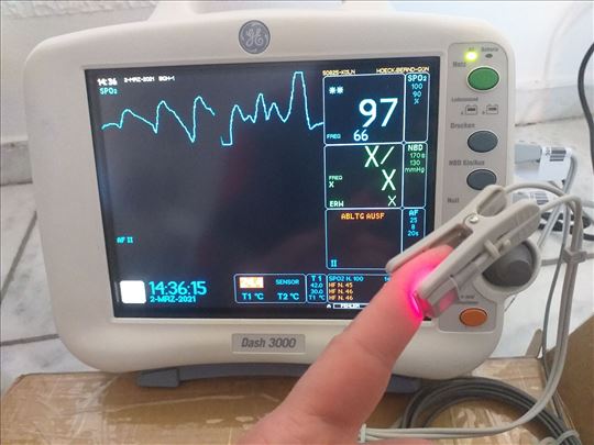 Pacijent monitor veterina- novi senzori 