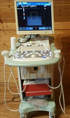 Ultrazvucni aparat-ultrazvuk