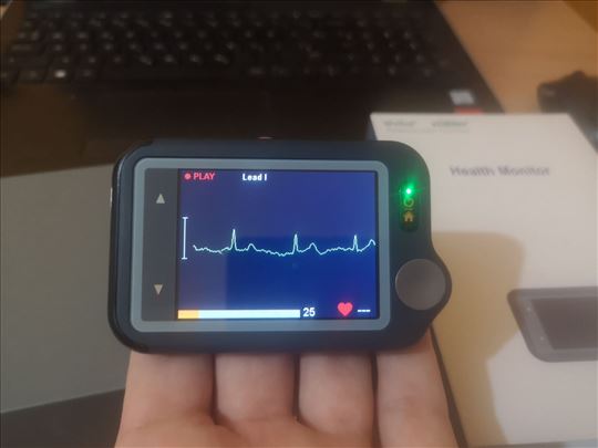 Wellue Viatom CheckMe Plus EKG monitor 