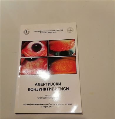 Alergijski konjuktivitisi Slobodan Golubović