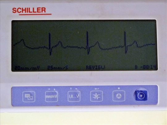 Schiller MINISCOPE MS-3 EKG 