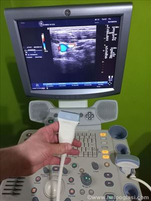 Ultrazvuk- ultrazvučni aparat - Muskulo sleletni