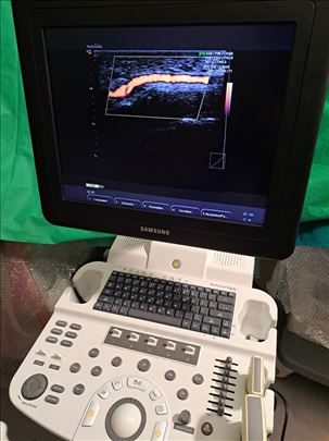 Ultrazvuk -ultrazvucni aparat 2016.god kao nov
