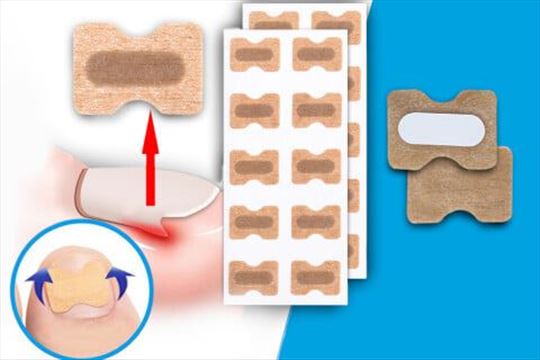 flasteri protiv uraslih noktiju 50 kom