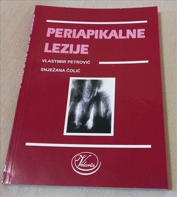 periapikalnae lezije