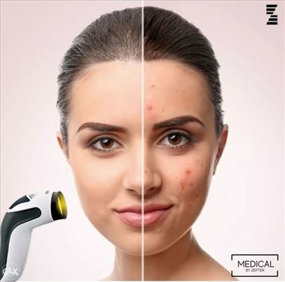 Bioptron medall sa stalkom zutim i fulerenskim fil