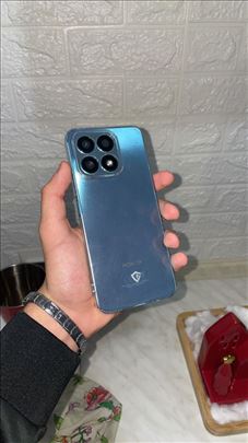 Honor X8a