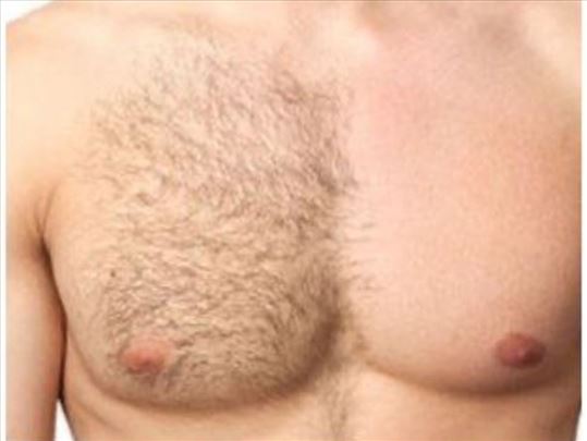 Depilacije Novi Beovrad