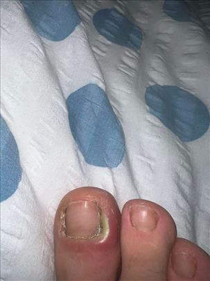 Profesionalni medicinski pedikir