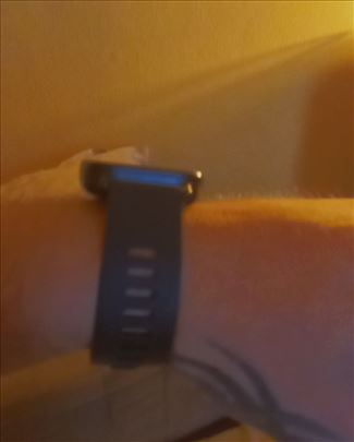 XIAOMI Pametni Sat Redmy 5 Lite