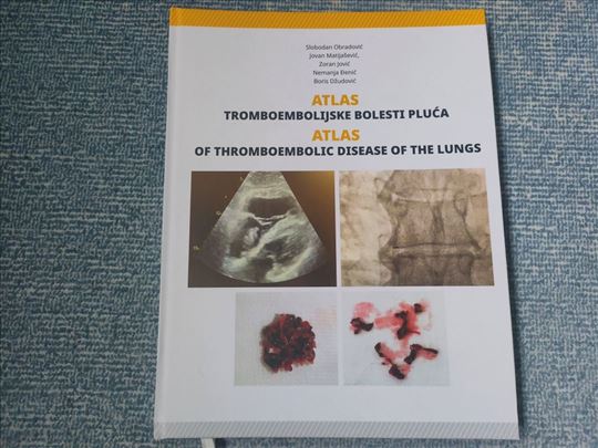 Atlas tromboembolijske bolesti pluća