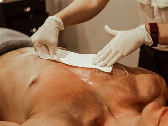 Intimna depilacija za muškarce Čuk.padina