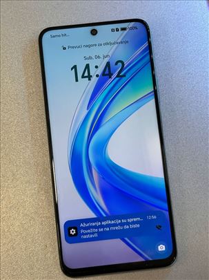 Honor x7b