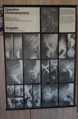 Vintage medicinski posteri Schering AG (par) - RET